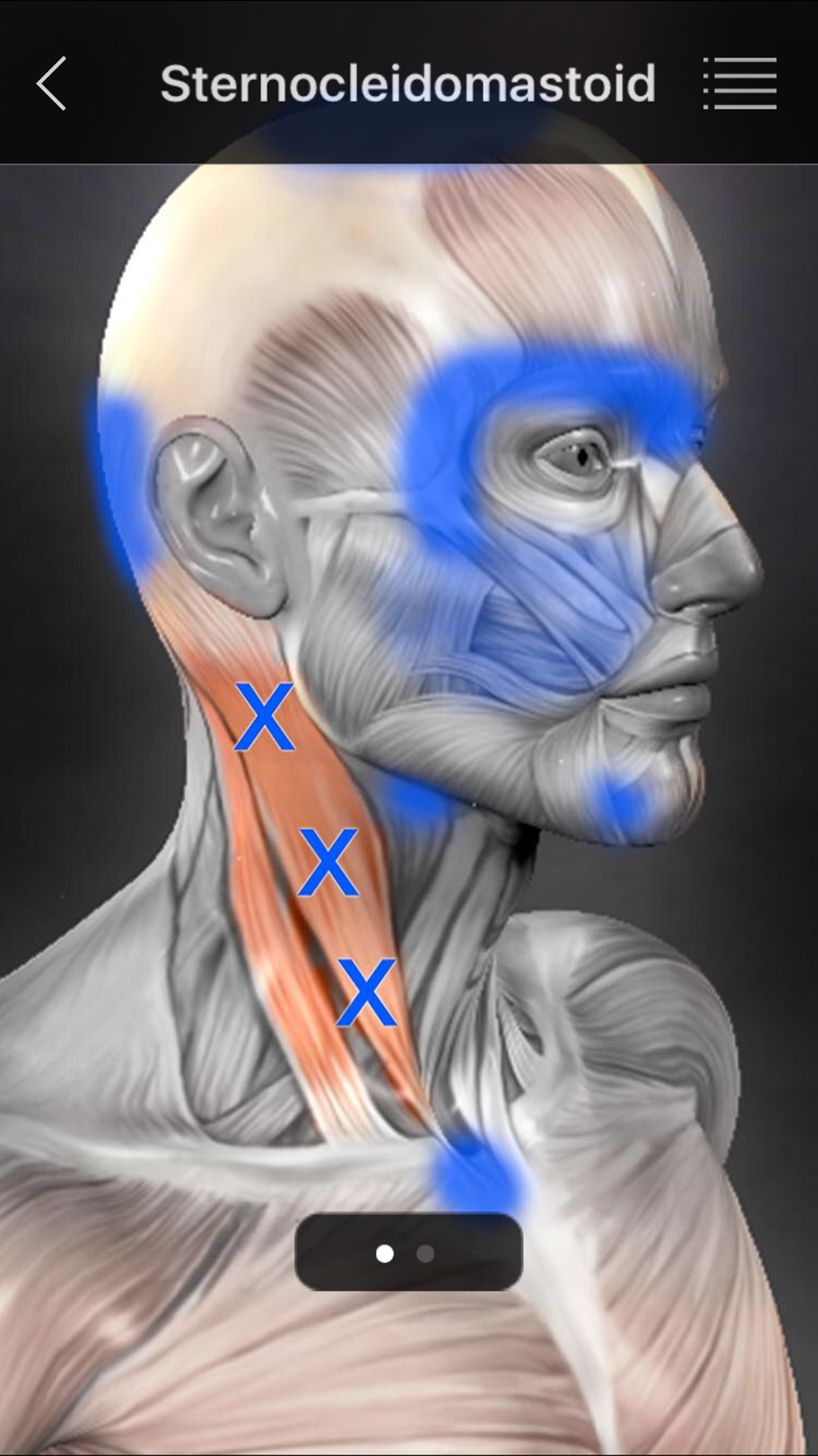 Captura de ecrã 2 da app Muscle Trigger Points