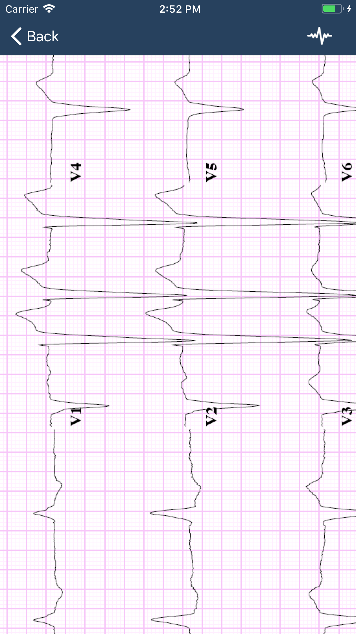 ECG Guide screenshot 3